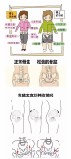 花都產(chǎn)后康復(fù)培訓|產(chǎn)后康復(fù)的正確順序