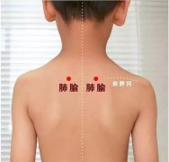 花都小兒推拿培訓(xùn)手法應(yīng)該注意哪些事項(xiàng)？