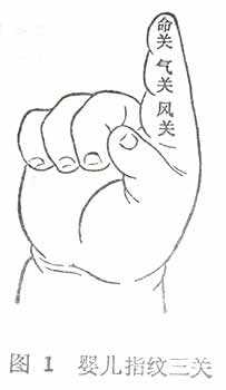 小兒指紋