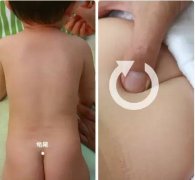 廣州小兒推拿培訓(xùn)|小孩感冒流鼻涕推拿手法
